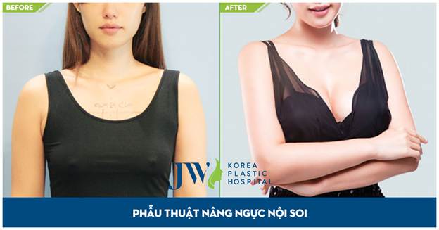 benh-vien-tham-my-jw