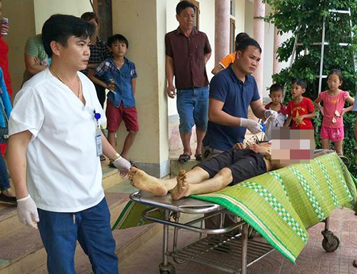 trau huc chet nguoi tapchithoidai